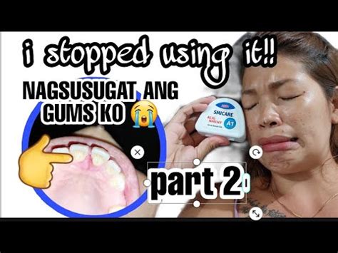 MY HONEST REVIEW ABOUT SMICARE A1 / NAGSUSUGAT .